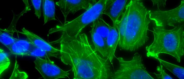 neurones2